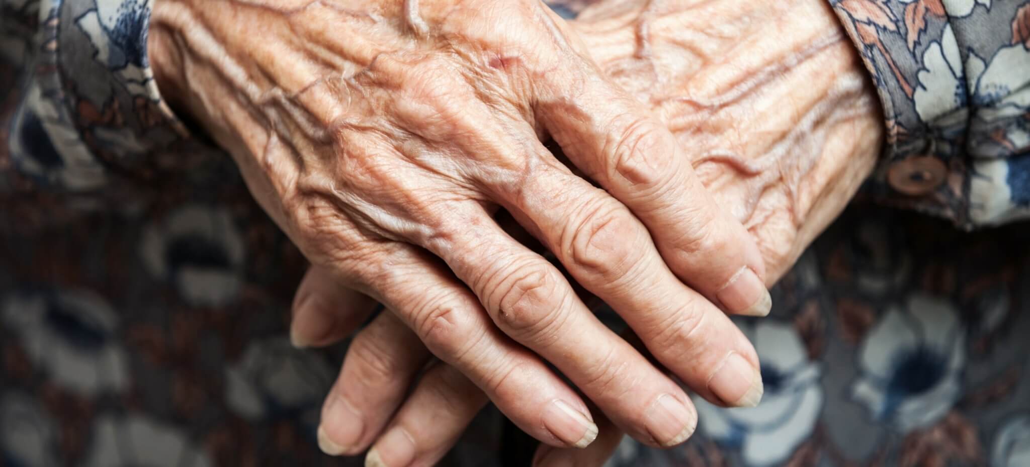 magere Hände einer sehr alten Dame